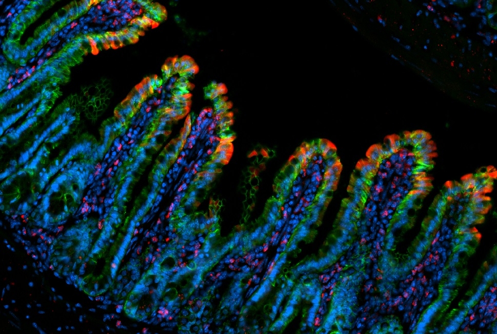 Intestinal villi confocal micrograph